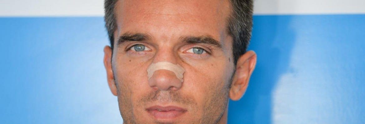 Fora da sedação, Alex de Angelis apresenta sinais de melhora