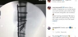 Márquez divulga imagens de fratura e operação via redes sociais